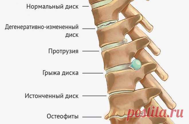 Гибкость и благополучие позвоночника! Гимнастика Мирзакарима Норбекова | Всегда в форме!