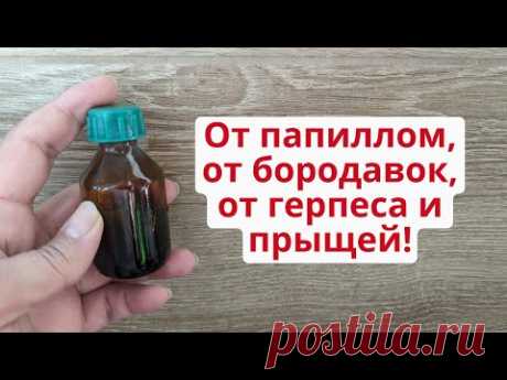 Удалить папилломы, бородавки, герпес и прыщи! 2 в 1 народное и аптечное средство!