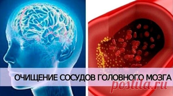 Очищаем сосуды головного мозга

Всем известно, что очистка внутренних органов необходима, чтобы избавиться от токсинов, шлаков, камней, песка, наростов кальция и других вредных вещей, которые накапливаются в нашем организме в процессе жизнедеятельности.

Чистка сосудов головного мозга: фитотерапия и народные методы лечения
Показать полностью...