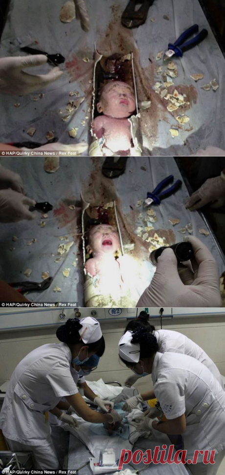 В Китае спасли новорожденного, которого смыли в унитаз • НОВОСТИ В ФОТОГРАФИЯХ