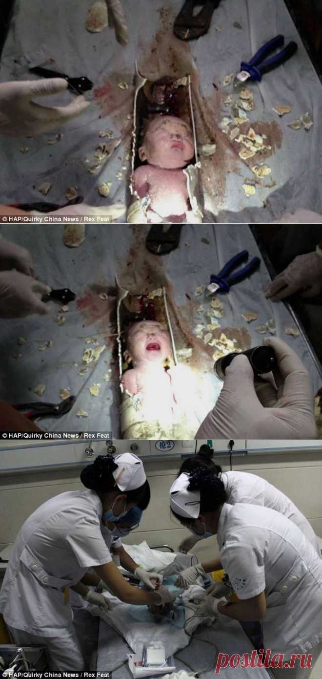 В Китае спасли новорожденного, которого смыли в унитаз • НОВОСТИ В ФОТОГРАФИЯХ