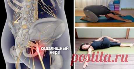8 простых упражнений, которые помогут избавиться от защемления седалищного нерва! Защемление седалищного нерва — патологическое состояние, которое возникает вследствие остеохондроза, грыж, новообразований, травм, а также из-за чрезмерного физического напряжения.