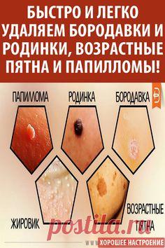 #удалить #бородавки #родинки #папилломы #пятна #здоровье #медицина