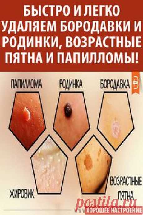 #удалить #бородавки #родинки #папилломы #пятна #здоровье #медицина