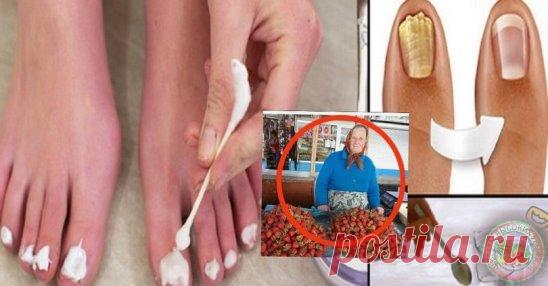 Народный способ избавиться от ГРИБКА от наших бабушек  который себя хорошо зарекомендовал.
Это метод избавления от грибка раствором уксуса с перекисью. Кислая среда губительная для многих грибов. Народные целители давно уже выбирают уксус, как одно из средств борьбы с этим неприятным заболеванием.
Можно сделать компресс и приложить его к пораженному ногтю. Для компресса достаточно смешать столовый уксус и перекись, в пропорции 1: 1, и пропитать таким раствором марлевый там...