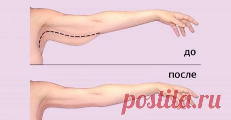 Как убрать жир с рук: 3 действенных способа. Хочу изящные изгибы! — СОВЕТНИК