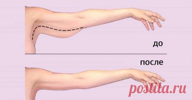 Как убрать жир с рук: 3 действенных способа. Хочу изящные изгибы! — Journal women❜s