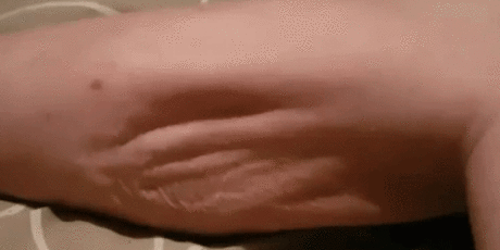 Откуда берутся судороги и что с ними делать - ПолонСил.ру - социальная сеть здоровья - медиаплатформа МирТесен Что делать, если болит зуб, а к стоматологу идти не хочется
Иногда бывает такой зуб, который не болит ни при каких условиях.
Просто не болит и все.
И вроде бы не мешает, но все равно не по себе.
А иногда такое бывает, что зуб болит даже в покое, например, когда сидишь или лежишь.
В этом случае надо идти к врачу, пока не стало хуже.
Почему болят зубы
Причины зубной боли
Зубная боль мож…