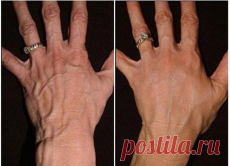 ЧУДО ОМОЛОЖЕНИЕ КОЖИ РУК — Сад Заготовка