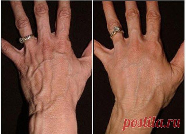 ЧУДО ОМОЛОЖЕНИЕ КОЖИ РУК — Сад Заготовка