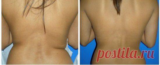 Коррекция фигуры с помощью мезотерапии
Коррекция фигуры сейчас очень востребована и мезотерапия приходит на помощь в этом, как она проводится, эффект мезотерапии и противопоказания к процедуре