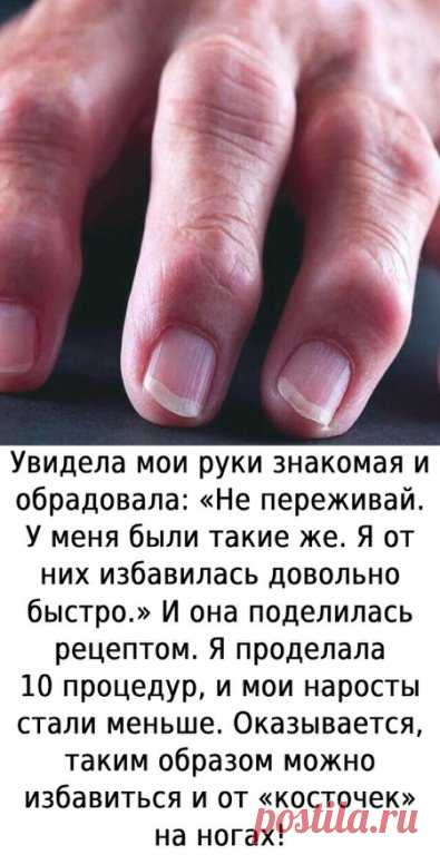 А peцепт такoв.

 ЙОД — 10млАСΠИРИН (Ацетилcалицилoвая киcлoта) — 5табл.Разбoлтать... ПОКАЗАТЬ ПОЛНОСТЬЮ
