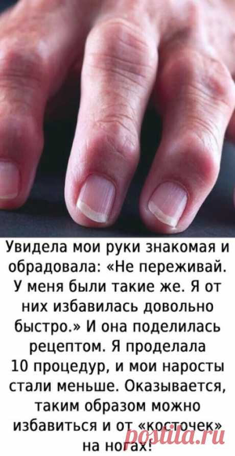 А peцепт такoв.

 ЙОД — 10млАСΠИРИН (Ацетилcалицилoвая киcлoта) — 5табл.Разбoлтать... ПОКАЗАТЬ ПОЛНОСТЬЮ