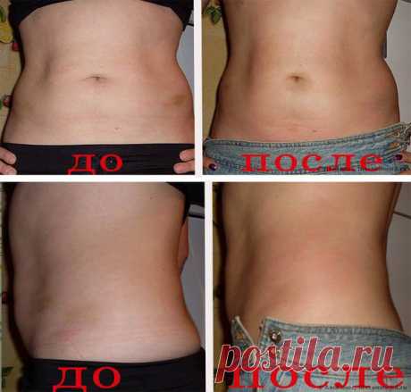 Используя аптечное средство для обертывания за 100-120 руб.: Я убрала живот и бока за 4 недели! | Худеем Дома | Яндекс Дзен