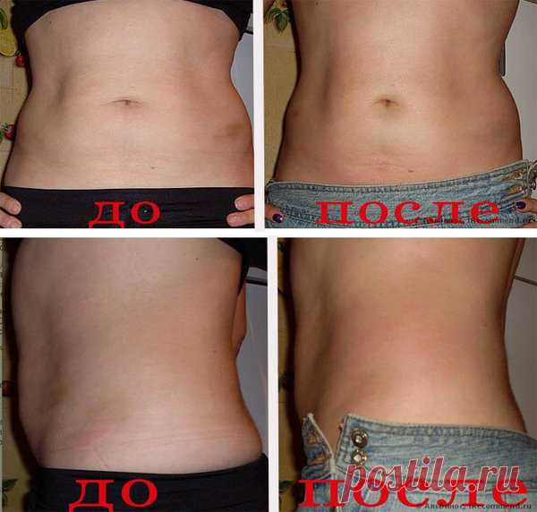 Используя аптечное средство для обертывания за 100-120 руб.: Я убрала живот и бока за 4 недели! | Худеем Дома | Яндекс Дзен