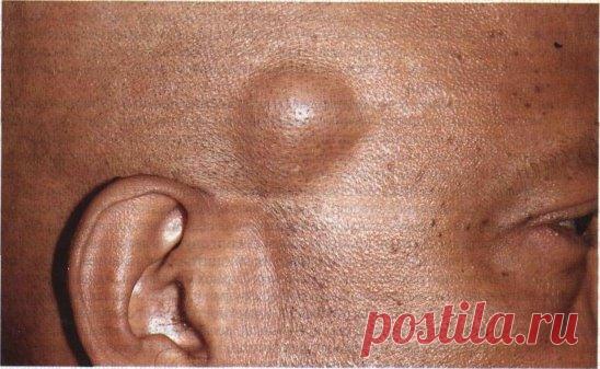 Накройте целлофаном и туго завяжите на ночь.