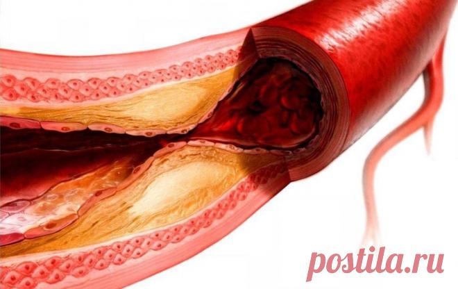 Болезни кровеносных сосудов. Сово-Сово — Омоложение и оздоровление!