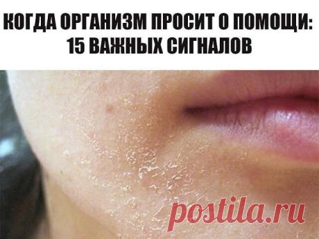 Когда организм просит о помощи: 15 важных сигналов