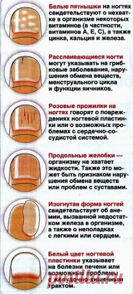 О КАКИХ ЗАБОЛЕВАНИЯХ ГОВОРЯТ ИЗМЕНЕННЫЕ НОГТИ))
