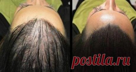 Средство для восстановления роста волос