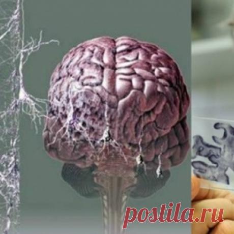 Кому грозит старческое слабоумие. Точный ответ академика Бехтерева