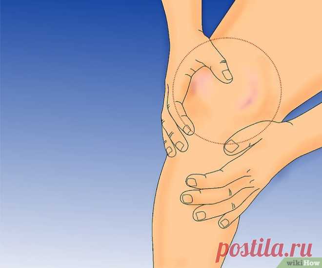 Как вылечить отекшее колено