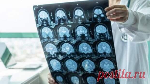 Высокий уровень сахара в крови может влиять на работу мозга даже у здоровых людей - Спички - не игрушка - Социальная сеть 