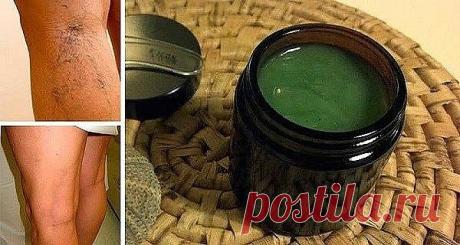 Мама избавилась от варикозного расширение вен с помощью простого рецепта от бабушки. Результаты заметны почти мгновенно!

Это стоит того, чтобы попробовать!