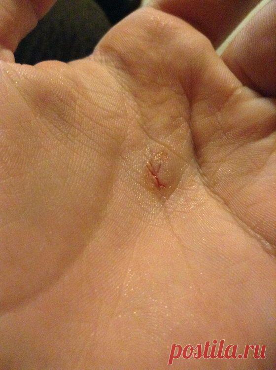 Не играй с ножичком...