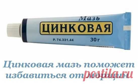 Цинковая мазь поможет избавиться от морщин