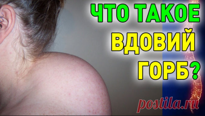 Вдовий горбик что это?