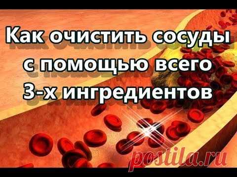 Как очистить сосуды с помощью всего 3 х ингредиентов