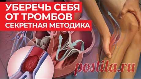 Тромбоз больше не страшен! / Народная профилактика тромбоза