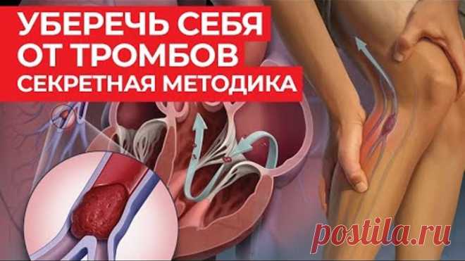 Тромбоз больше не страшен! / Народная профилактика тромбоза