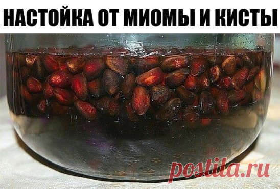 От миомы и кисты настойка из кедровых орешков
Настойка из кедровых сибирских орешков лечит миому матки и кисту яичников.
Приготовление настойки:
Один стакан кедровых орешков вместе с кожурой и ядрами залить 0,5 литра водки (или разведённого спирта), настоять 2 недели в тёмном месте, периодически встряхивая.
Приём настойки:
По одной столовой ложке настойки три раза в день, за 30 минут до еды. Можно развести в 40 мл. воды.
Лечение длительное, 3-6 месяцев. В идеале надо выпить 6 бутылок, но м