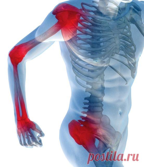 Народное средство от боли в суставах - поможет каждому!