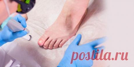 Грибок ногтей: экспертное мнение специалистов Sensavi