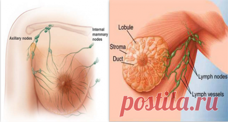 Причины рака молочной железы!
