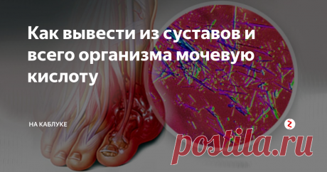 Как вывести из суставов и всего организма мочевую кислоту Делюсь с вами рецептами эффективных средств для выведения мочевой кислоты из организма. Проверено многими людьми. Результат уже через несколько дней!
Артрит бывает нескольких видов, одним из которых является подагра. Она доставляет очень сильную боль в суставах, в особенности она интенсивна в области больших пальцев ног. Помимо этого появляется отек, покраснение и начинает бросать в жар. Причинами