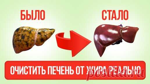 Необычный способ очистить печень от жира, эти два ингредиента избавят вас гепатоза. | Доктор Сагдиев | Дзен
