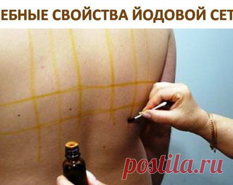 Целебные свойства йодовой сетки
