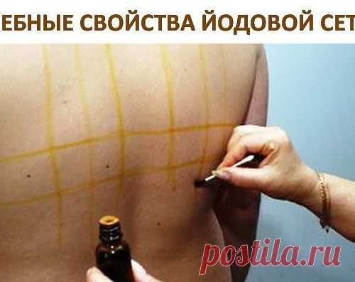 Целебные свойства йодовой сетки