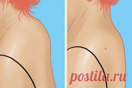 Вдовий горбик вам не нужен. срочно начинайте делать эти упражнения! (видео)
Мне эти упражнения очень помогли! Как избавиться от некрасивой холки на шее раз и навсегда? Этот вопрос мучает множество женщин. Соблюдая рекомендации и упражнения теперь это стало реально в домашних условиях! Эту проблему не редко называют «вдовий горбик», так она возникает у женщин, переживших климакс. Но, современные...
Читай пост далее на сайте. Жми ⏫ссылку выше