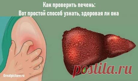 Как проверить печень: Вот простой способ узнать, здоровая ли она Как проверить печень: Вот простой способ узнать, здоровая ли она.В 90% печень оказывается больна.БываетКак проверить печень:Вот простой способ