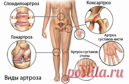 ВОССТАНАВЛИВАЕМ СУСТАВНУЮ ТКАНЬ

С этой проблемой сталкиваются очень многие, после пятидесяти вообще чуть ли не каждого суставы беспокоят. Но вот единицы знают, как это все просто восстанавливается...