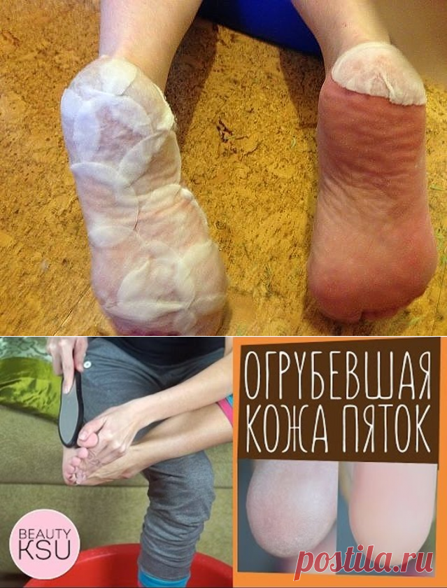 (11) Одноклассники