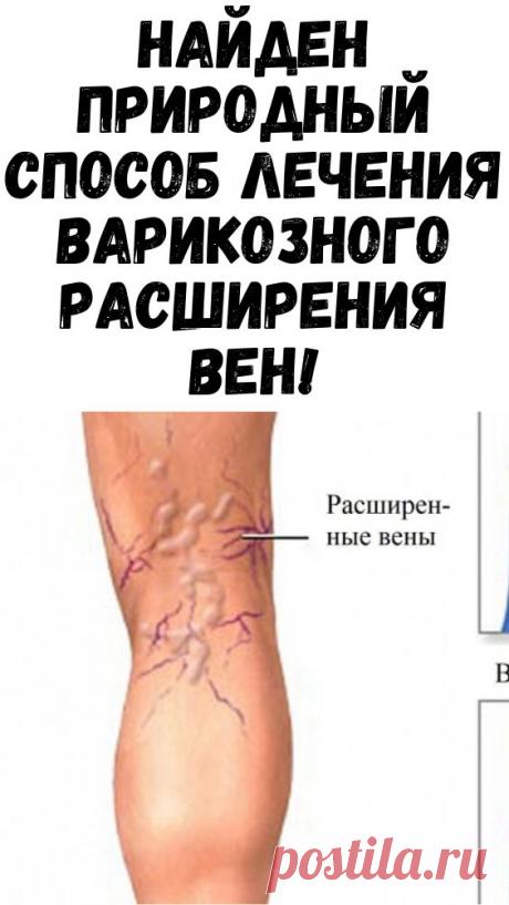 НАЙДЕН ПРИРОДНЫЙ СПОСОБ ЛЕЧЕНИЯ ВАРИКОЗНОГО РАСШИРЕНИЯ ВЕН!
пасхальные приметы окрашивание яиц на Пасху