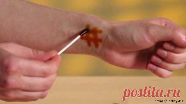 Йодная сетка: проблемы, которые она способна решить