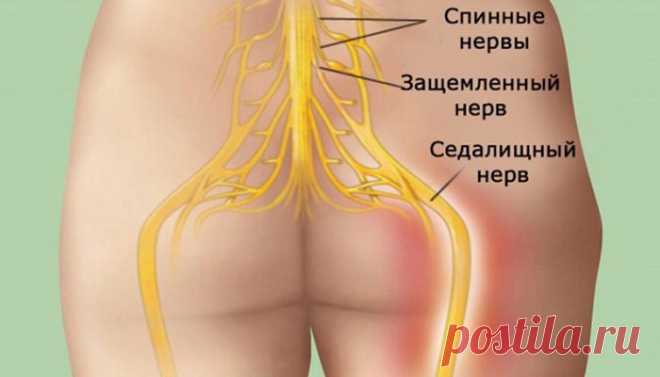 Попрощайтесь с болью в спине! Достижение успеха в 95 % случаев Одной из наиболее распространенных проблем со здоровьем, с которыми сталкиваются люди в настоящее время, является боль в нижней части спины.
Наше тело состоит из нервов, мышц, связок и кровеносных сос…