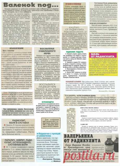 Радикулит